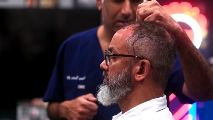 Hair transplant chicago